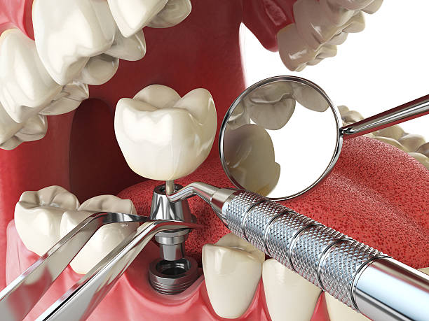 Best Emergency Gum Treatment in Makawao, HI